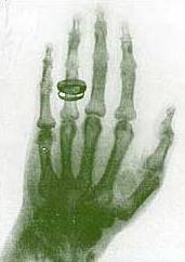 Soubor:Roentgen wife hand.jpg